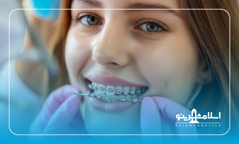 بهترین سن برای ارتودنسی چه زمانی است؟