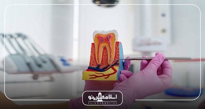 توصیه های بهترین دندانپزشک درمان ریشه در اسلامشهر