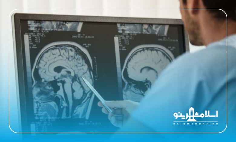 وظایف متخصص مغز و اعصاب در اسلامشهر