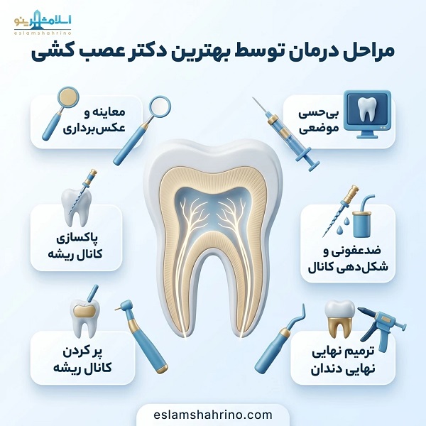 بهترین دکتر عصب کشی در اسلامشهر چه ویژگیهایی دارد؟