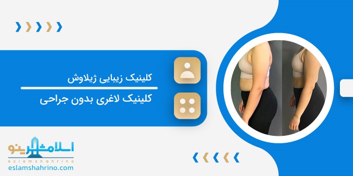کلینیک زیبایی ژیلاوش