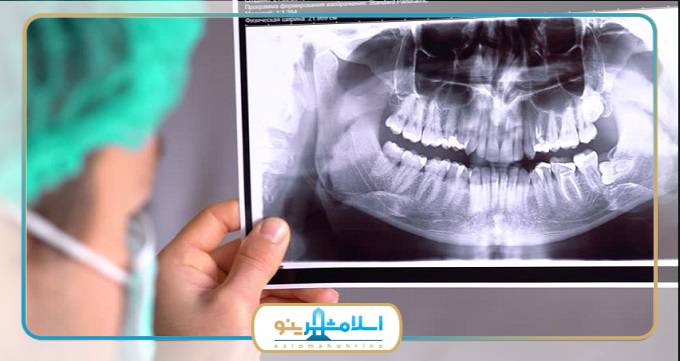 بهترین مرکز رادیولوژی دندان در اسلامشهر