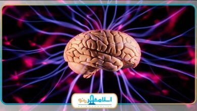 بهترین متخصص مغز و اعصاب در اسلامشهر