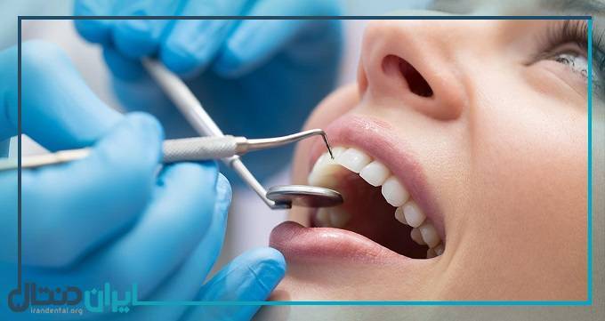 5 روش جلوگیری از زرد شدن کامپوزیت دندان