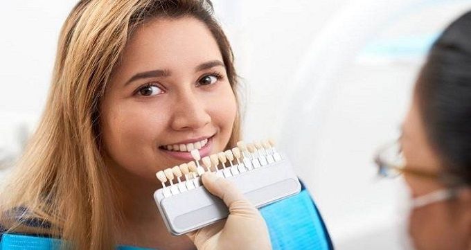 انواع روش های لمینت دندان 