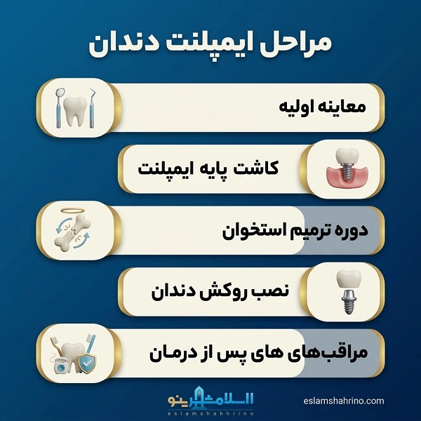 چگونه بهترین دکتر ایمپلنت در نسیم شهر را شناسایی کنیم؟
