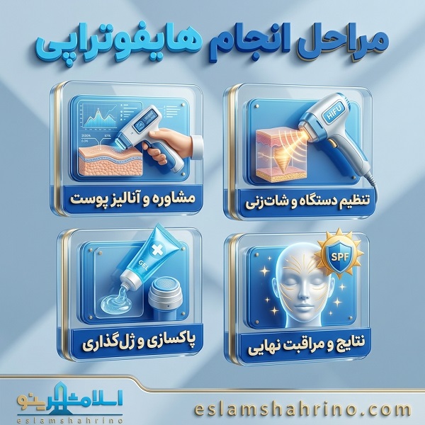 مراحل انجام هایفوتراپی